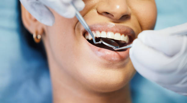Best Emergency Dental Care for Abscessed Tooth in Seis Lagos, TX